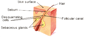 Acne - Sebaceous Gland